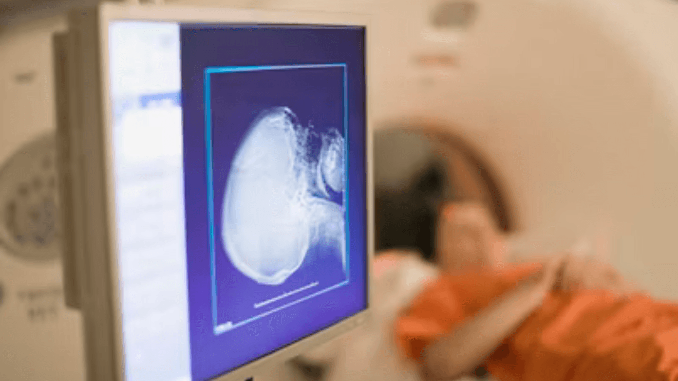 Warning over metal near MRI machines after man dies by being pulled into machine