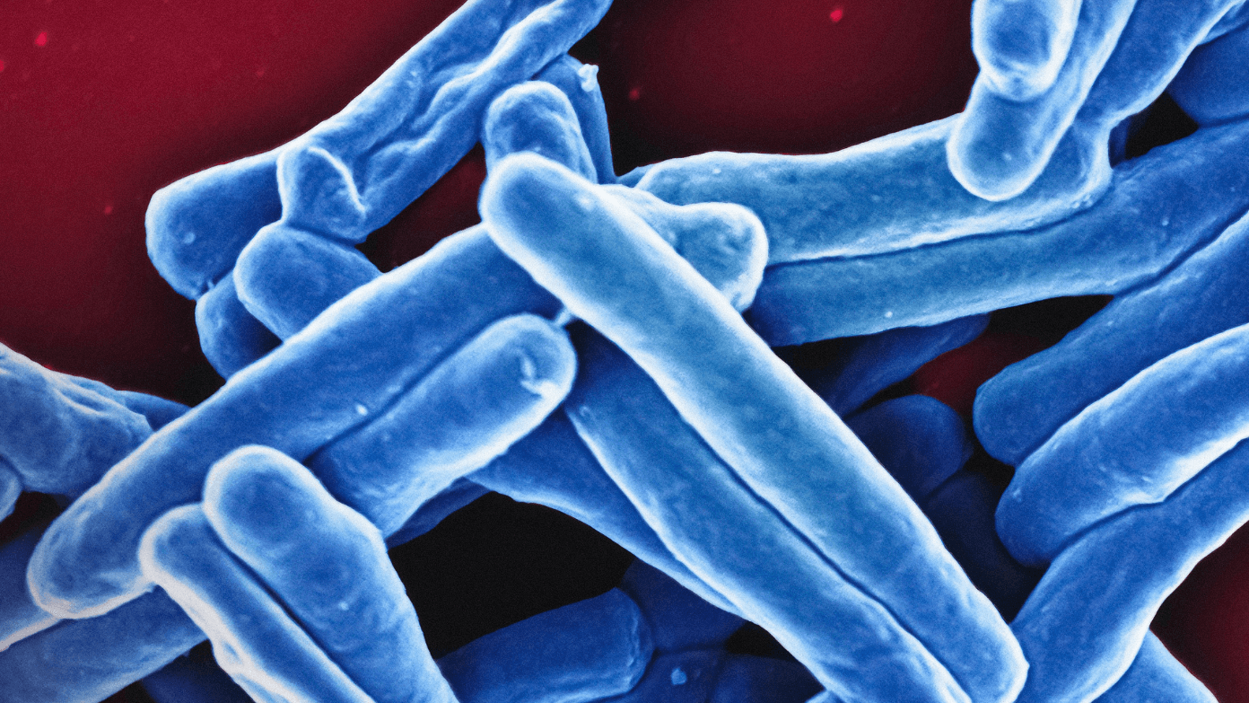 Check your fridge—Wegmans is recalling certain cheeses due to potential listeria contamination. Here’s exactly what to look for and where it was sold.